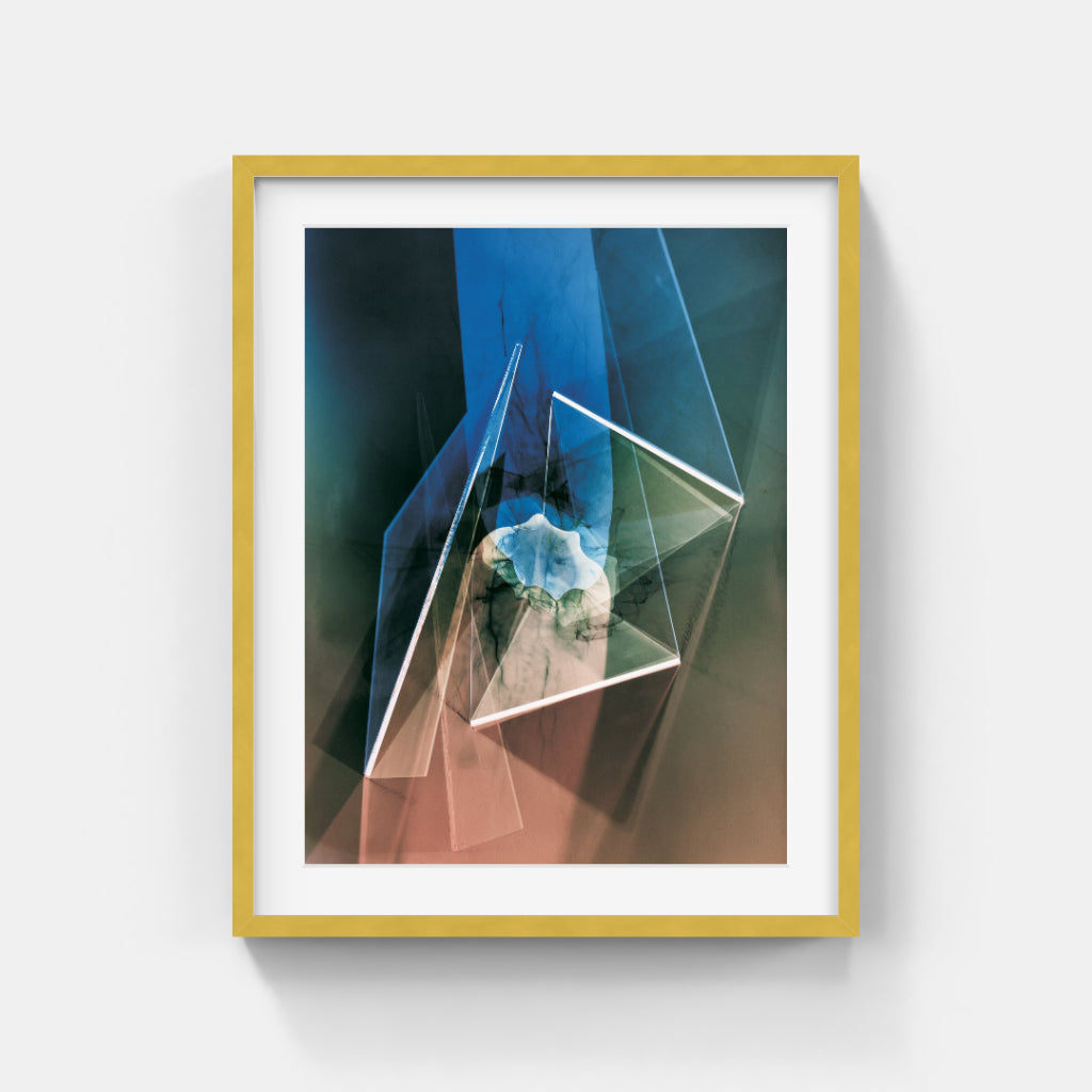 Vince Reichardt - Radiation therapy V